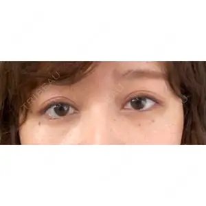 湘南美容クリニック 湘南美容クリニック 赤坂見附院口コミ