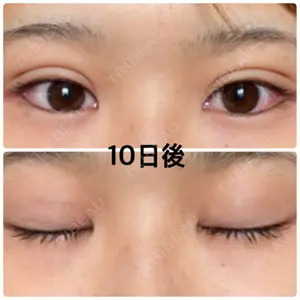 口コミ