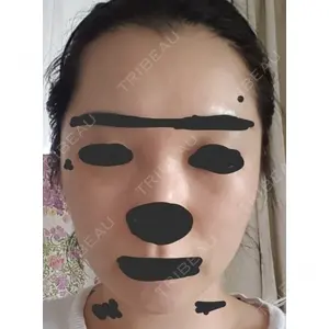 ボンディ美容整形外科（旧リオン整形外科）口コミ