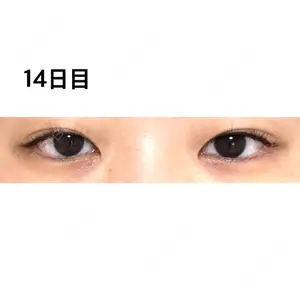 口コミ