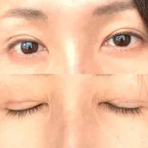 口コミ