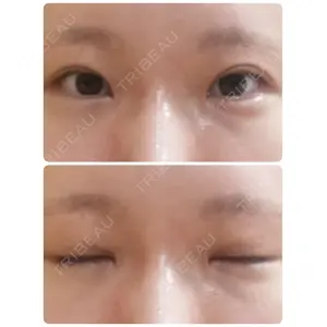 聖心美容クリニック グループ 聖心美容クリニック 六本木院口コミ