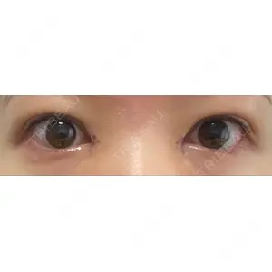 口コミ