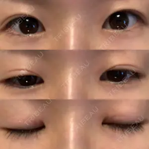 ニドークリニック名古屋口コミ