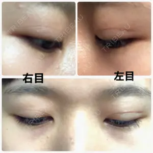 湘南美容クリニック 湘南美容クリニック 赤坂見附院口コミ