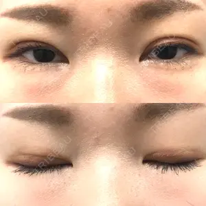 口コミ