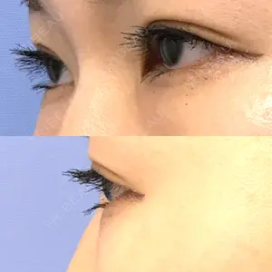 口コミ