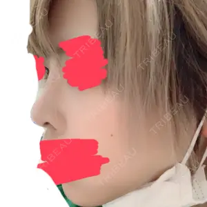 リッツ美容外科 大阪院口コミ