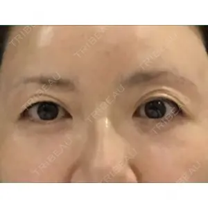 口コミ