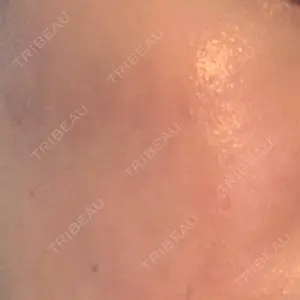 品川スキンクリニック 品川スキンクリニック心斎橋院口コミ