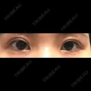 ルネッサンス美容外科医院 ルネッサンス美容外科医院 東京院口コミ