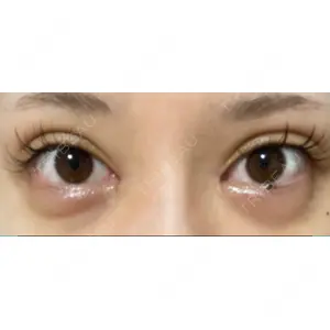 湘南美容クリニック 湘南美容クリニック 自由が丘院口コミ