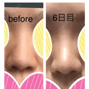 銀座ゼロクリニック口コミ