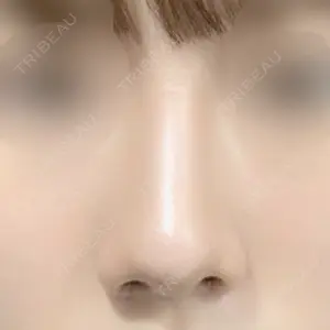 マーブル整形外科口コミ