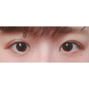 口コミ