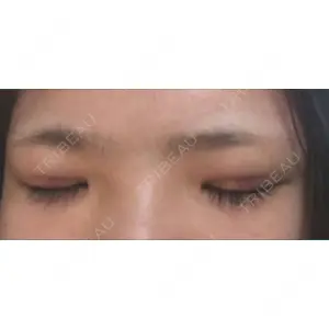 湘南美容クリニック 湘南美容クリニック 京都院口コミ