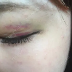 湘南美容クリニック 湘南美容クリニック 京都院口コミ