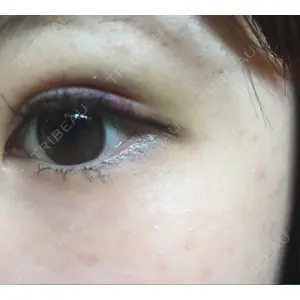 湘南美容クリニック 湘南美容クリニック 京都院口コミ