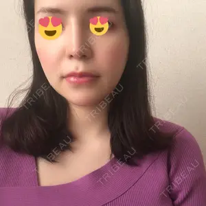 口コミ