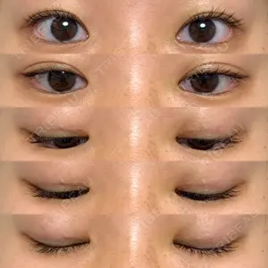R.O.clinic口コミ