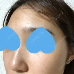 南青山TOKUNAKAクリニック口コミ