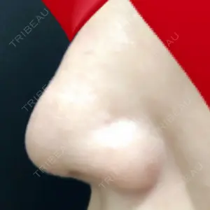 銀座ゼロクリニック口コミ