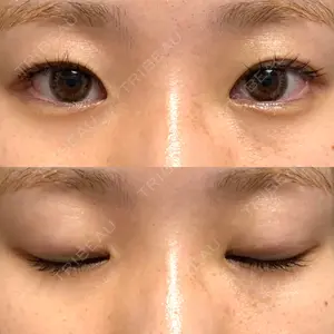 R.O.clinic口コミ