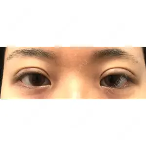 口コミ