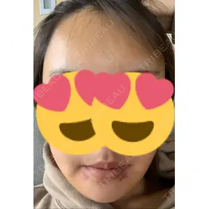 オペラ整形外科口コミ