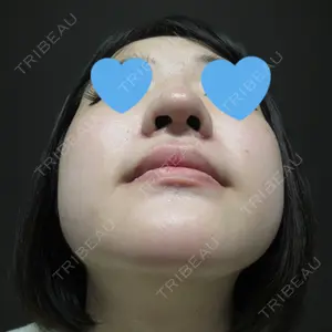 口コミ