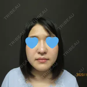 口コミ