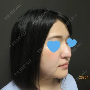 口コミ