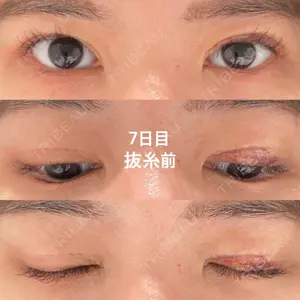 口コミ