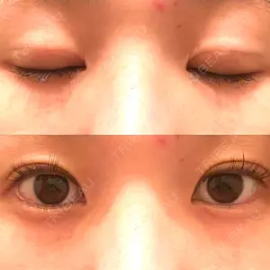 口コミ