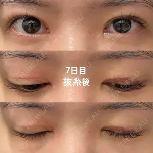 口コミ