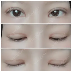 松下皮フ形成外科口コミ