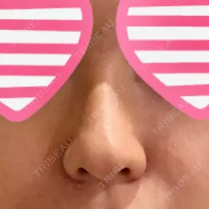 プラストクリニック口コミ