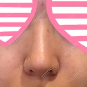 プラストクリニック口コミ