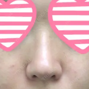 プラストクリニック口コミ