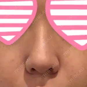 プラストクリニック口コミ