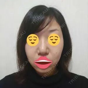 リッツ美容外科 大阪院口コミ