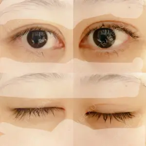 いちのせ形成外科・皮膚科 眼瞼＆フェイスクリニック口コミ