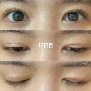 口コミ