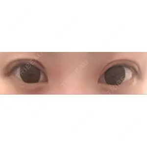 口コミ