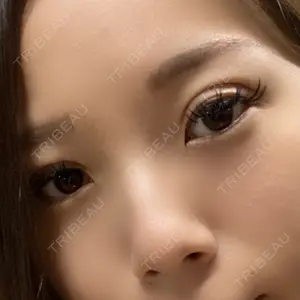 TCB東京中央美容外科 TCB東京中央美容外科 梅田茶屋町院口コミ