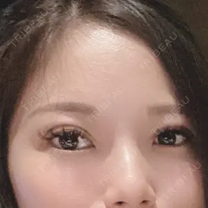 TCB東京中央美容外科 TCB東京中央美容外科 梅田茶屋町院口コミ