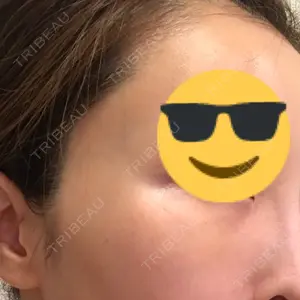 東京イセアクリニック口コミ