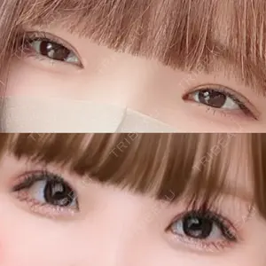 湘南美容クリニック 湘南美容クリニック 赤坂見附院口コミ