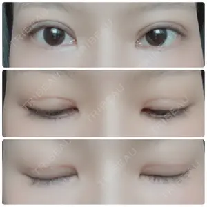 松下皮フ形成外科口コミ