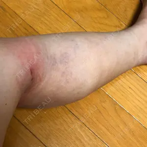 口コミ
